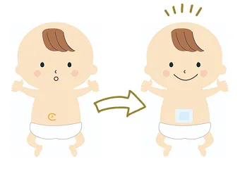 でべそ（臍ヘルニア）